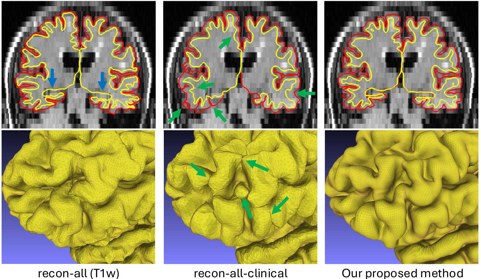 Surface reconstruction example