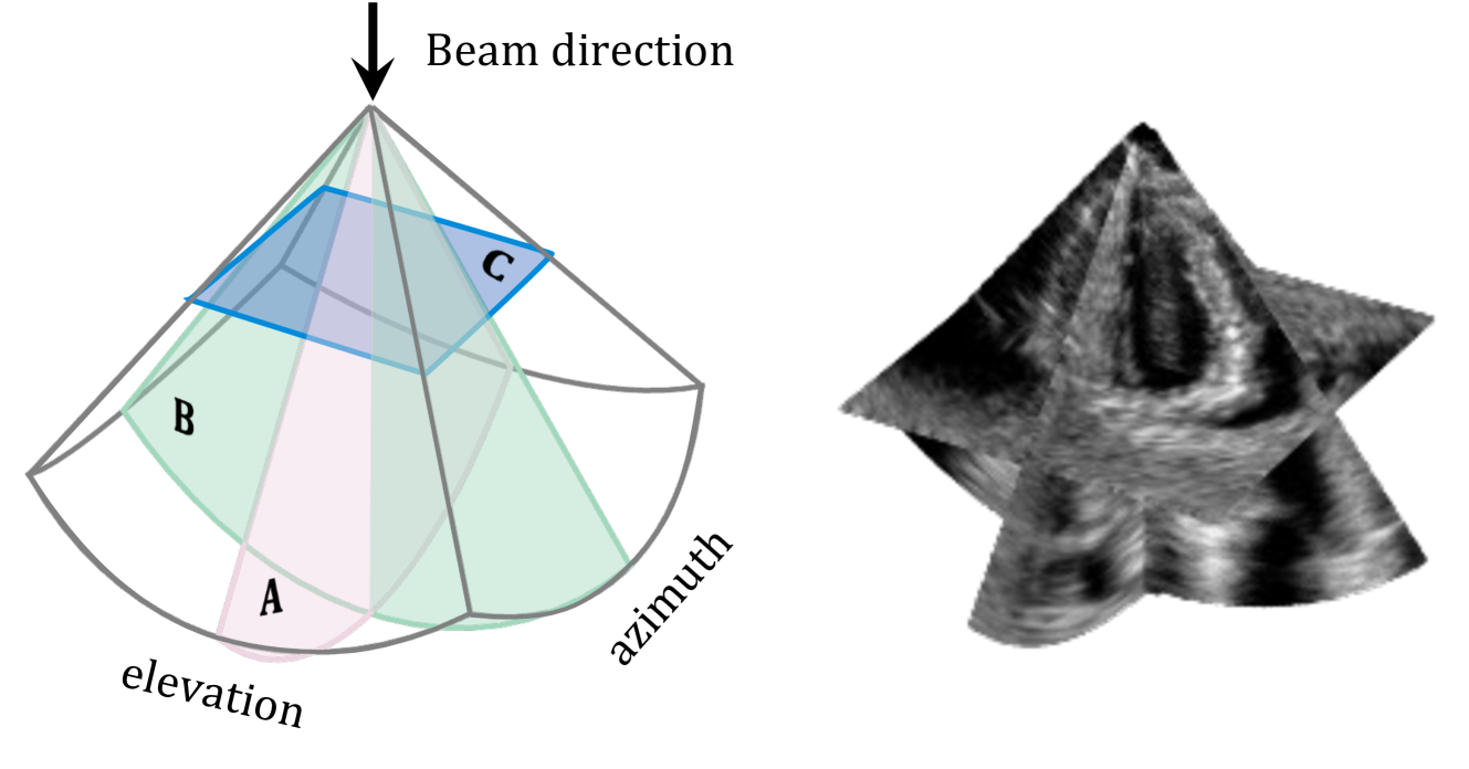 High Volume Rate 3D Ultrasound Reconstruction with Diffusion Models ...