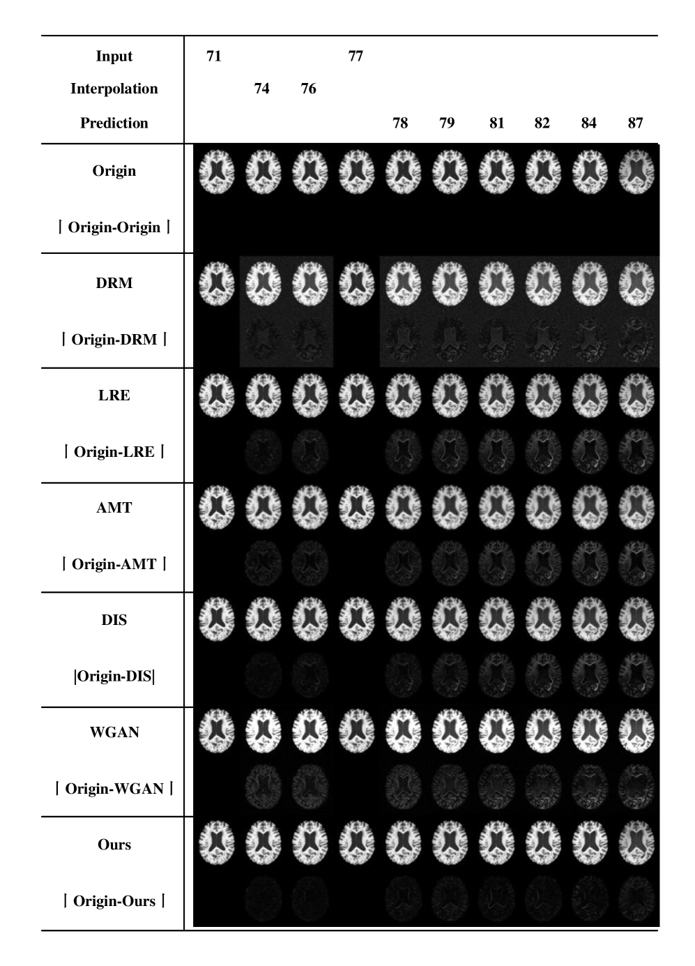 This model accurately predicts longitudinal brain changes in ADNI-1 subjects by interpolating images for ages 74 and 76 and then forecasting images from ages 78 to 87, as demonstrated by the close correspondence between predicted and actual brain structures.