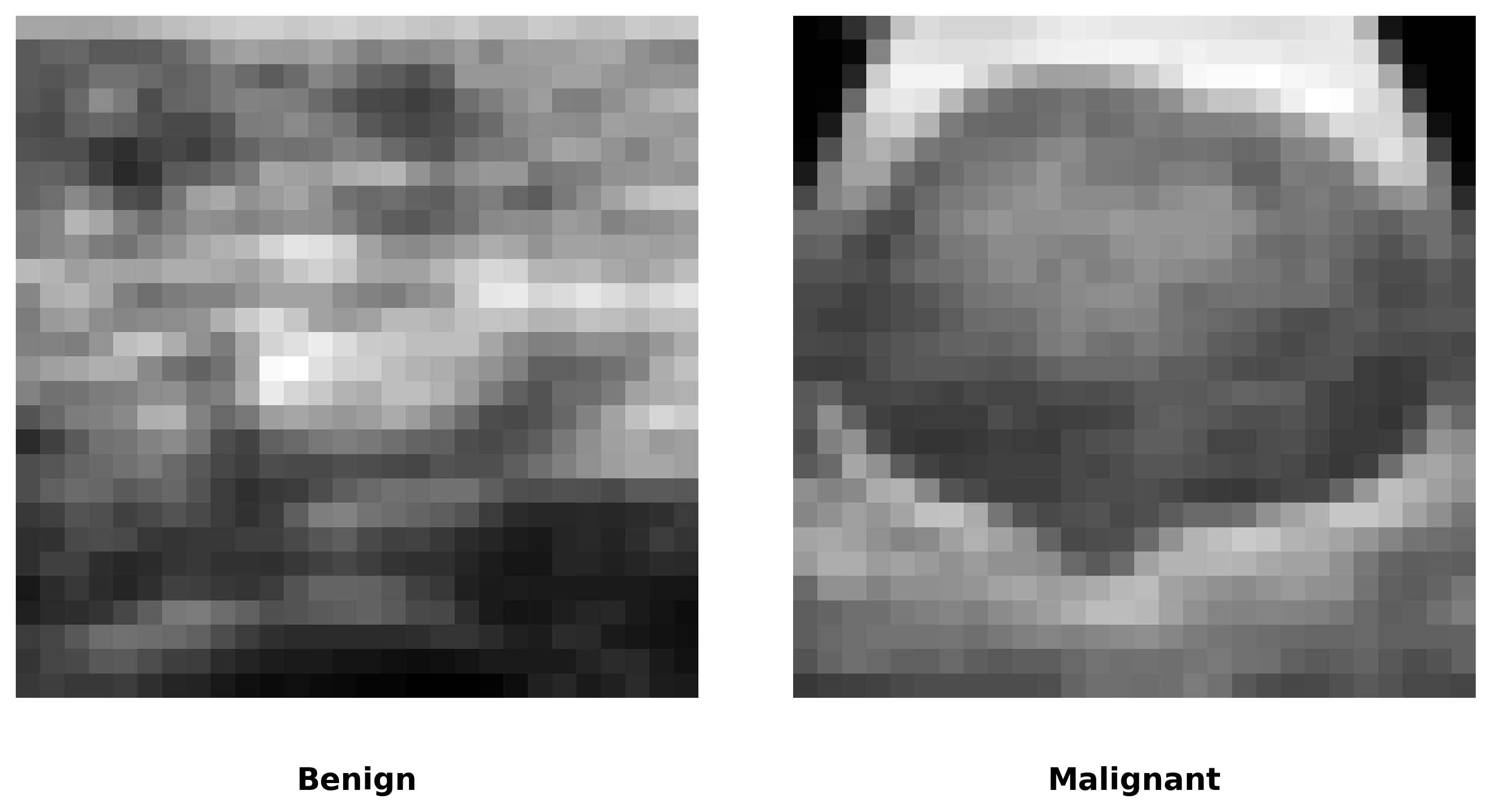 Набор данных BreastMNIST содержит образцы как доброкачественной, так и злокачественной ткани молочной железы, используемые для обучения моделей.