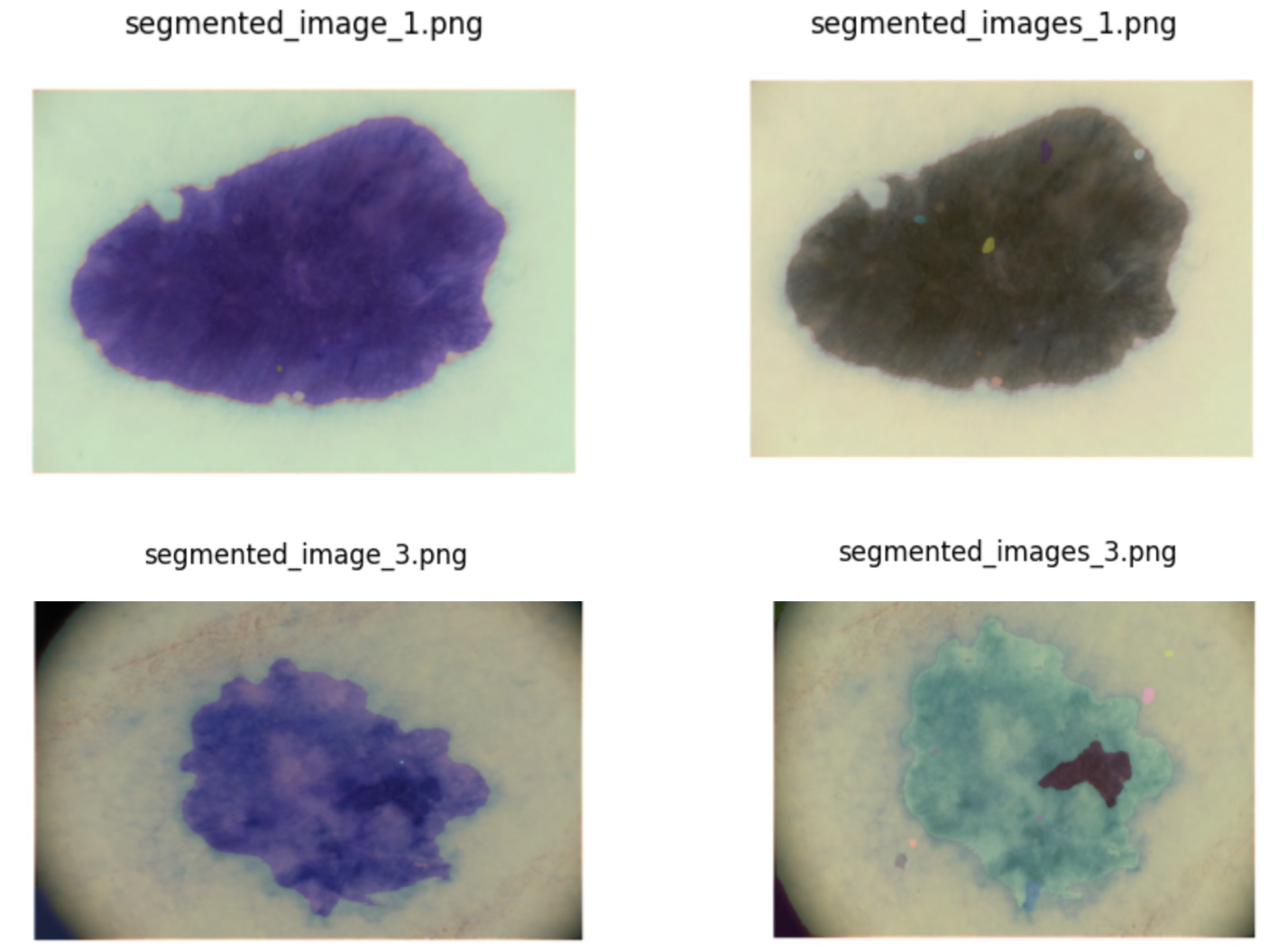 Lesion masks were generated utilizing SAM, demonstrating its capacity to delineate affected areas for further analysis.
