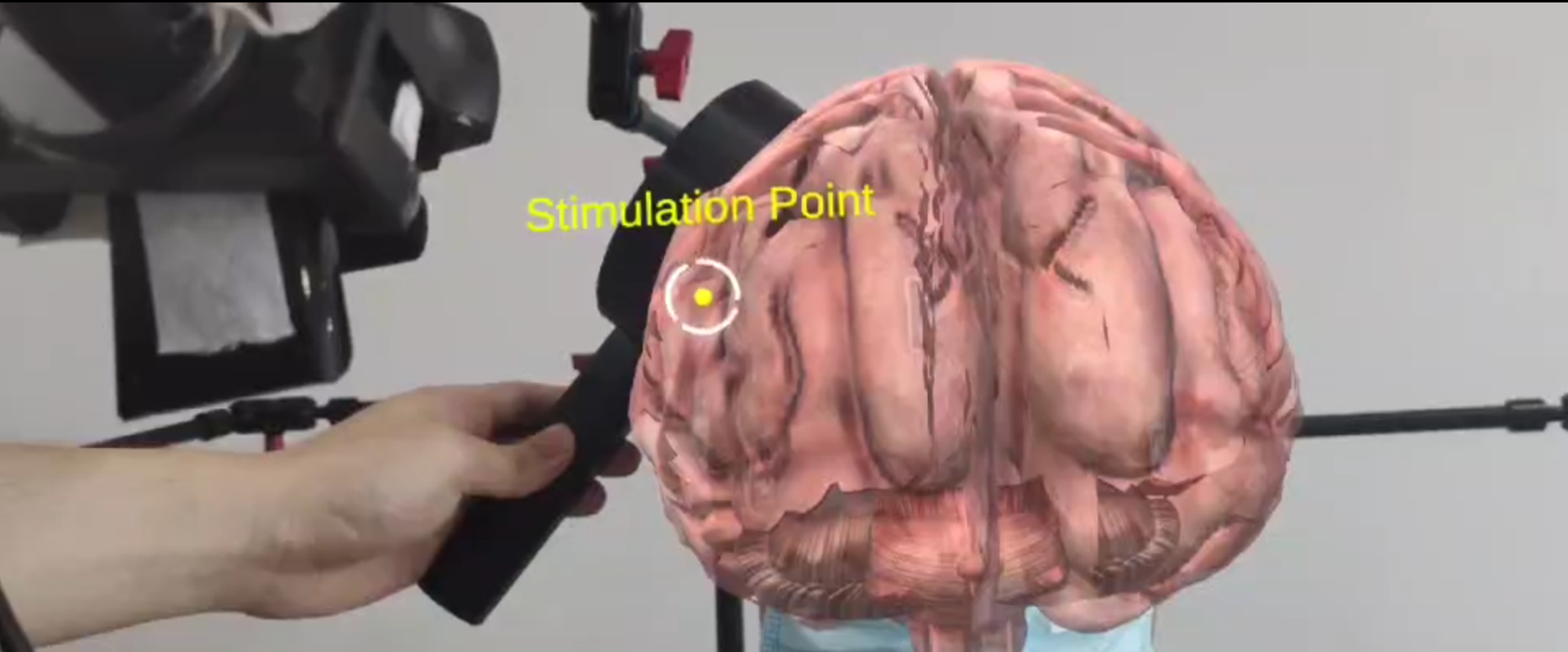Система нейронавигации обеспечивает визуализацию точки транскраниальной магнитной стимуляции (TMS) в реальном времени, интегрируя её с цифровой моделью мозга в Unity и накладывая на изображение головы пациента в режиме дополненной реальности.