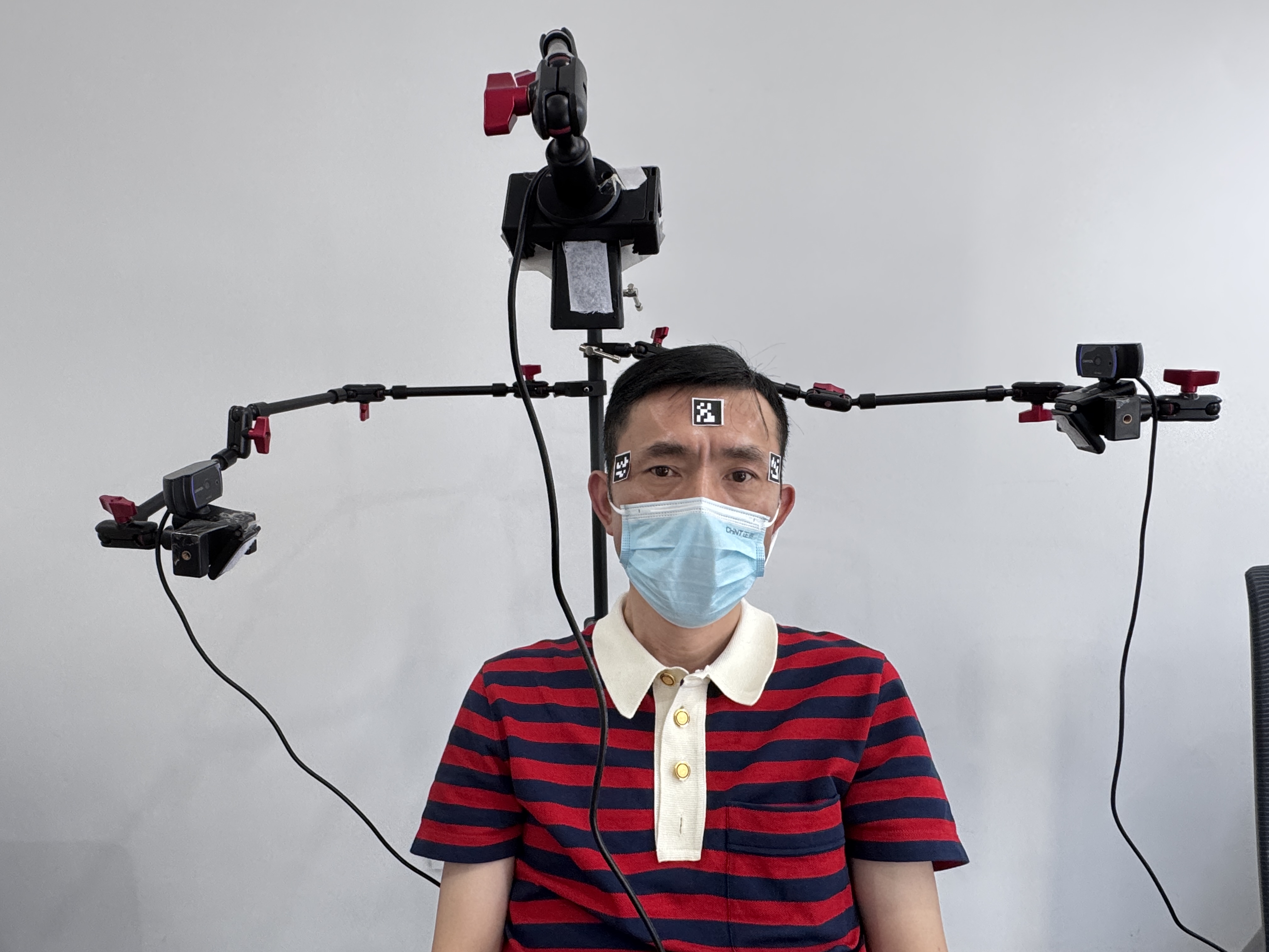 Многокамерная система TMS-навигации, включающая катушку TMS, систему отслеживания и оптические маркеры, обеспечивает точное определение положения и ориентации отслеживаемых объектов в единой координатной системе.