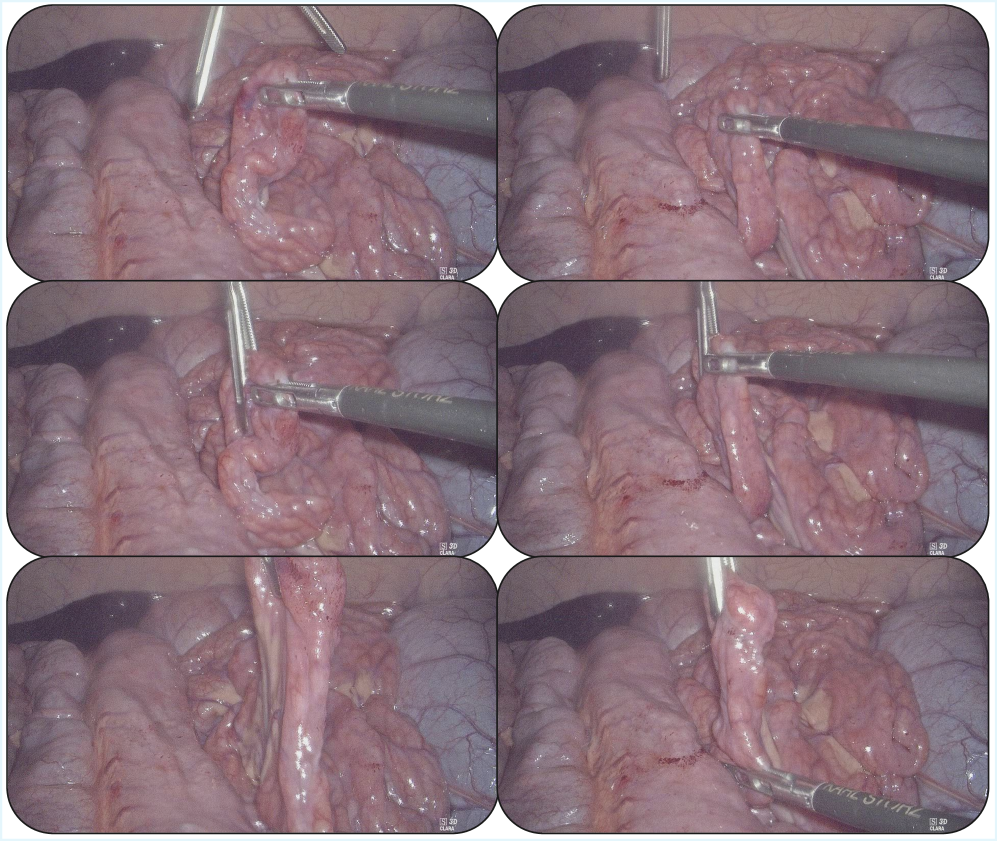 The study demonstrates a MoE-ACT policy’s adaptability during porcine surgery, successfully navigating distinct phases - reach, grasp, and retract - and suggesting a system where capability emerges from iterative refinement rather than predetermined design.