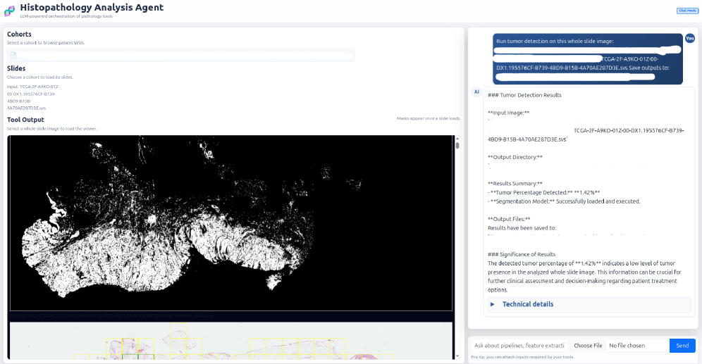 The tool orchestration subsystem automatically detects tumors in whole slide images by invoking a segmentation tool that generates a binary mask highlighting tumor regions and suppressing surrounding tissue.