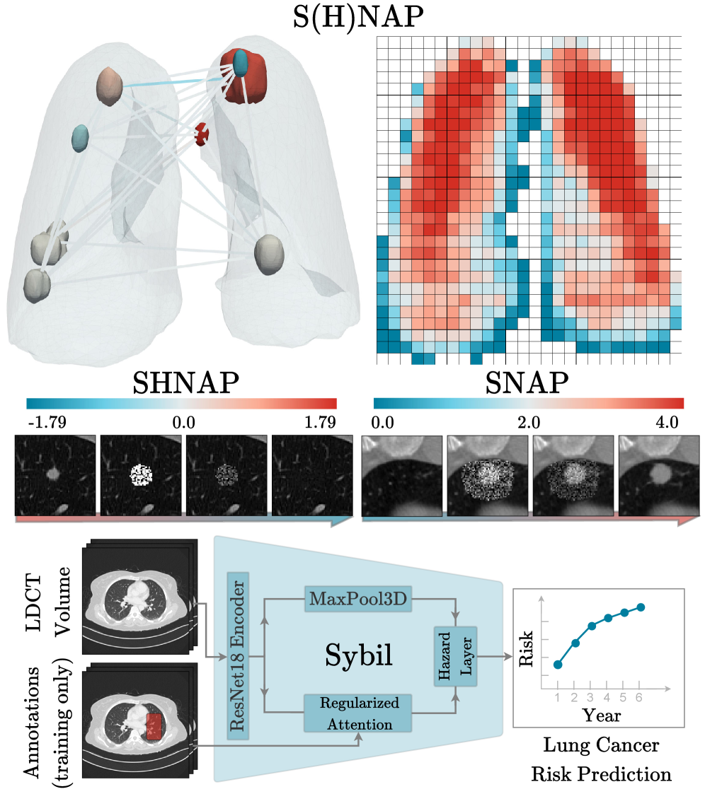 A novel framework, S(H)NAP, audits lung cancer risk prediction models-such as Sybil-by leveraging diffusion-bridge-based generative interventions on pulmonary nodules, decomposing predictions into individual nodule contributions and inter-nodule interactions via healthy tissue substitution, and probing volumetric sensitivity through systematic insertion of nodules with known malignancy to reveal spatial biases in risk estimation-ultimately providing a means to assess the model’s reliance on spurious correlations rather than true pathological indicators.