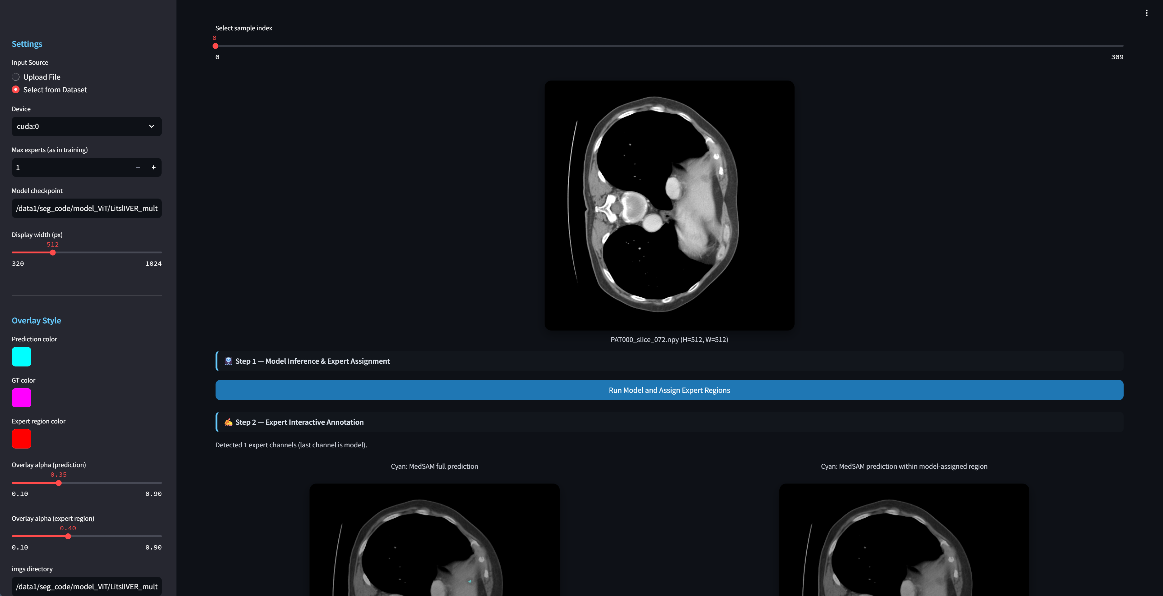 Figure 5: DeferredSeg interactive expert-annotation interface. The page shows (top) model prediction and routing results, (middle) per-expert canvases for interactive corrections, and (bottom) the fused segmentation and ground-truth comparison.